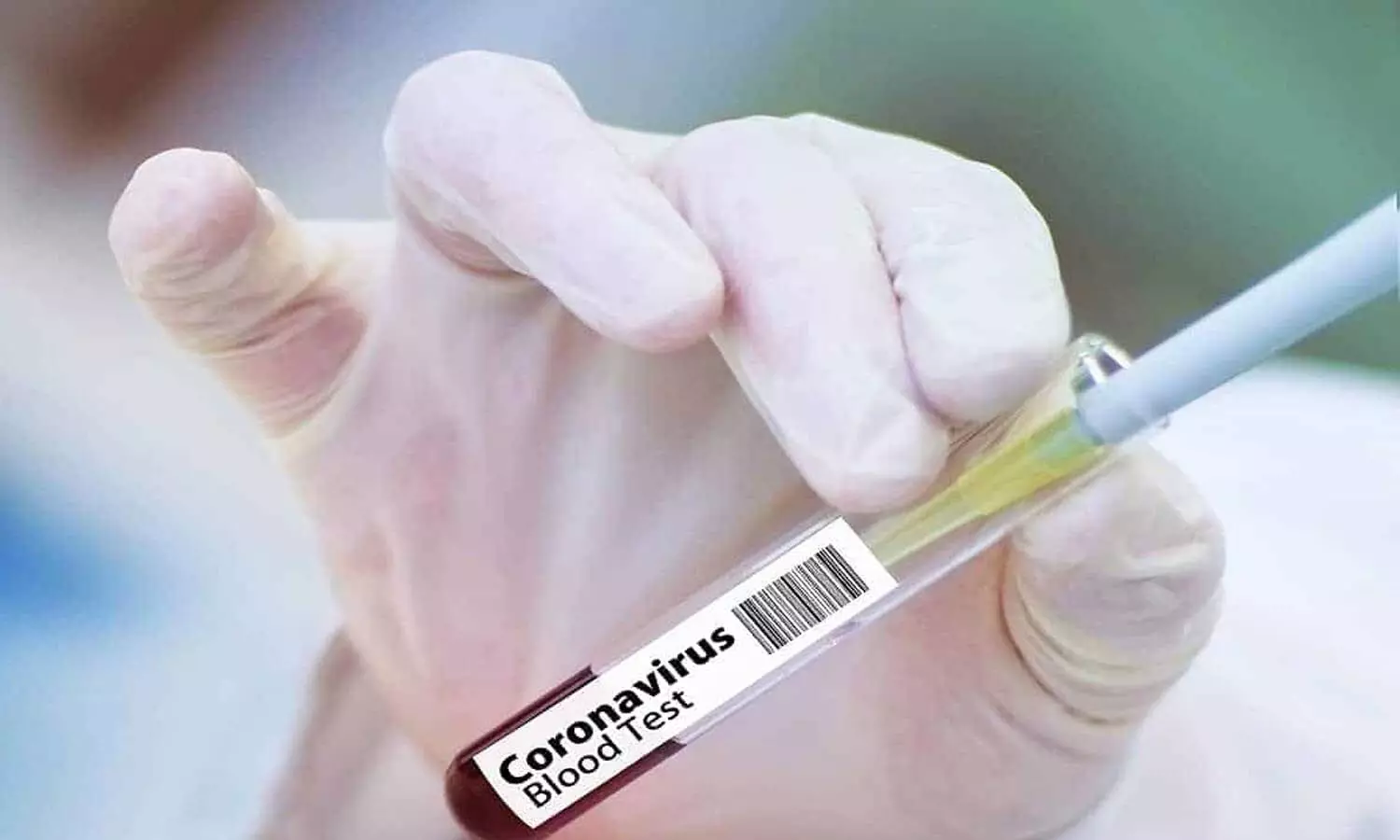 corona, positive cases, deaths, recovery, india