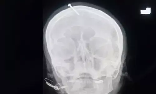 అమ్మాయిని అబ్బాయిగా మారుస్తానంటూ.. నిండు గర్భిణీ తలలో మేకు దించిన దొంగ బాబా