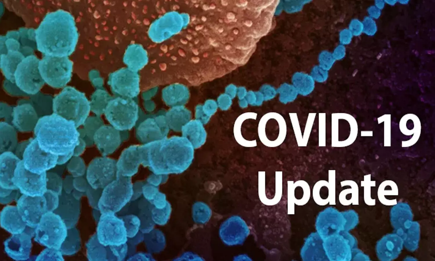 ఏపీలో భారీగా తగ్గిన కరోనా కేసులు ఏపీలో భారీగా తగ్గిన కరోనా కేసులు