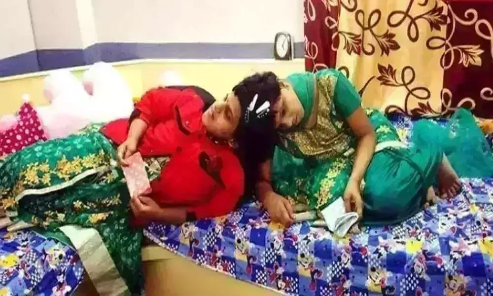 12వ తరగతి పరీక్షలకు హాజరవుతున్న అవిభక్త కవలలు