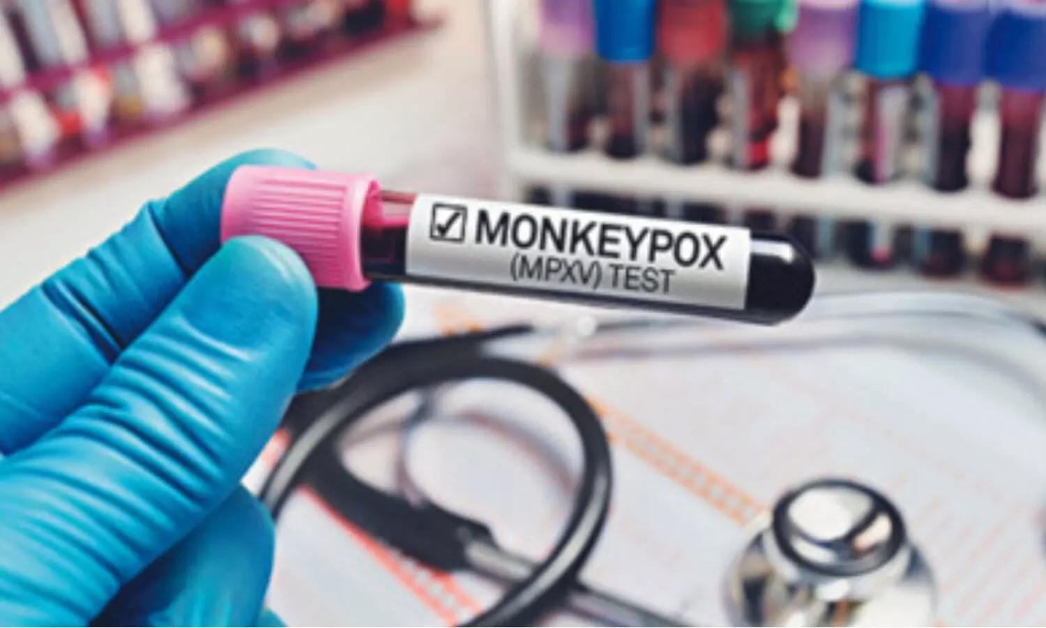 monkeypox, delhi, india