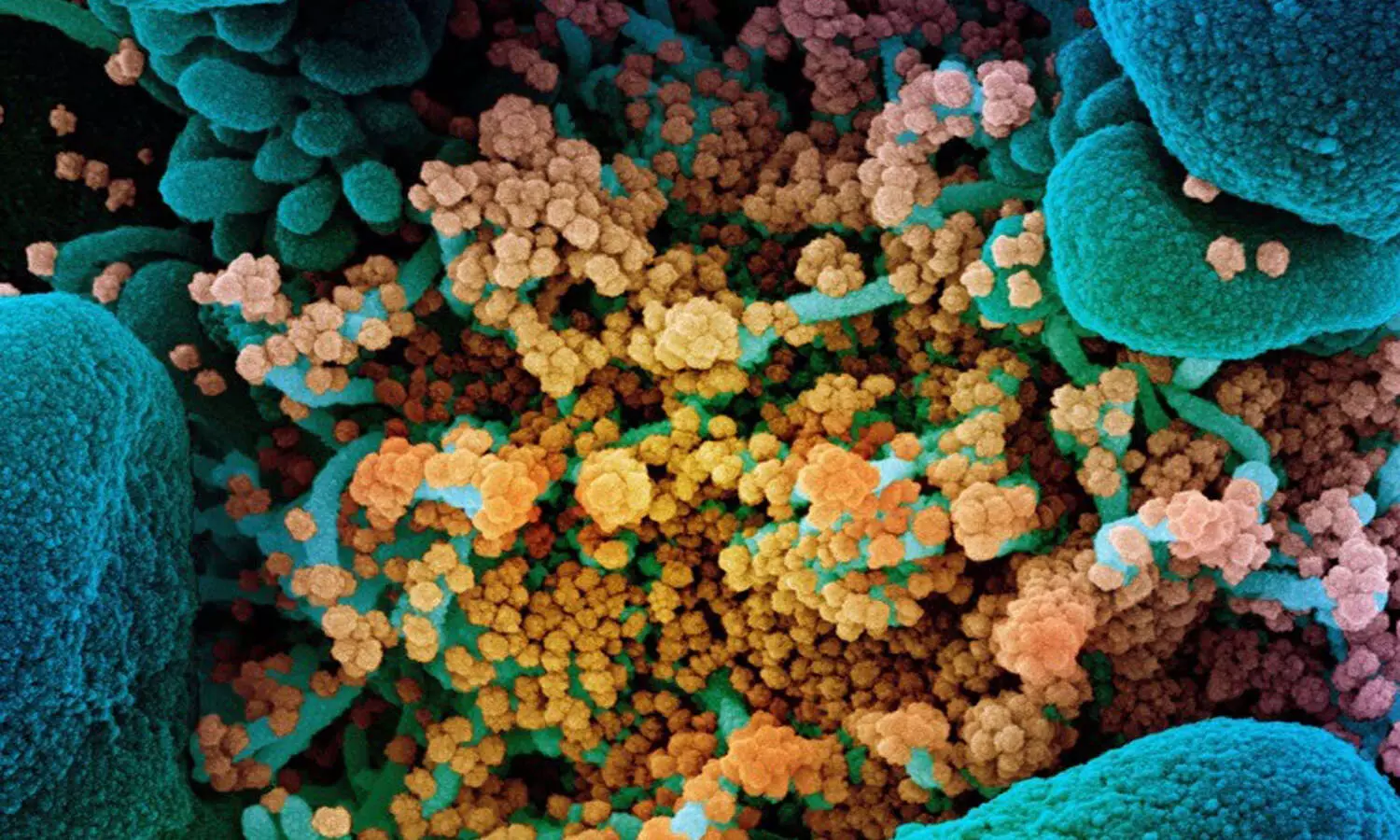 భారత్ లో భారీగా తగ్గిన కేసులు