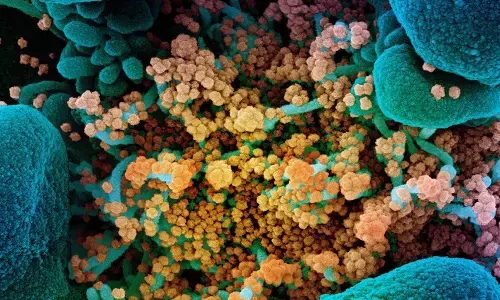 భారత్ లో భారీగా తగ్గిన కేసులు