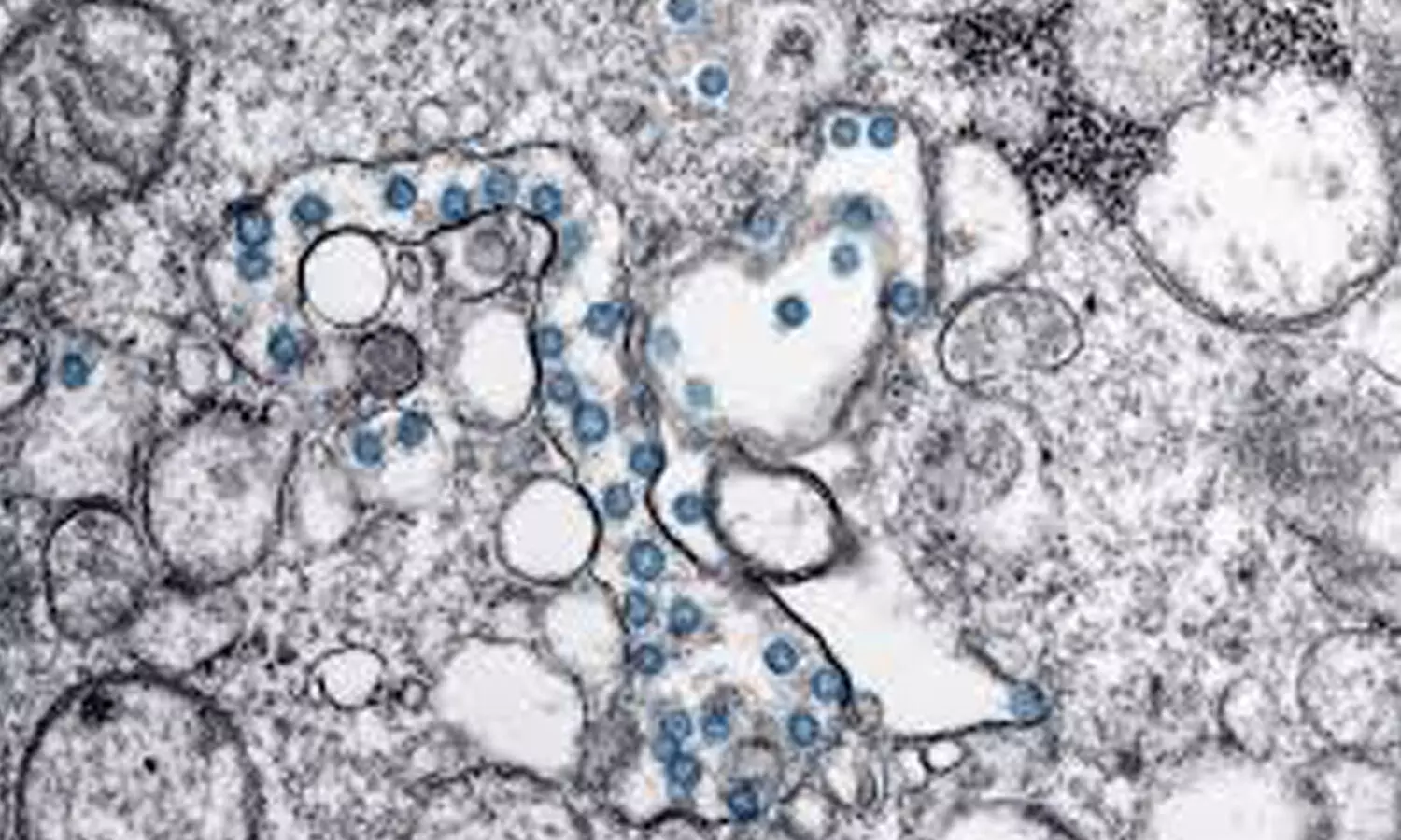 తగ్గినట్లే తగ్గి మళ్లీ పెరుగుతుందే తగ్గినట్లే తగ్గి మళ్లీ పెరుగుతుందే