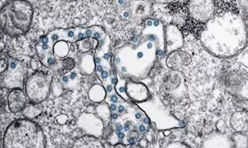 తగ్గినట్లే తగ్గి మళ్లీ పెరుగుతుందే