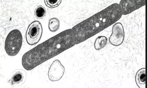 అల్లూరి జిల్లాలో అంత్రాక్స్.. వణుకుతున్న గిరిజనులు