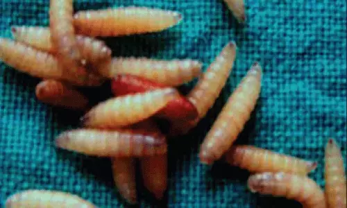 ముక్కులో ఏకంగా ఈగల 150 లార్వాలు.. మెదడు దాకా..!