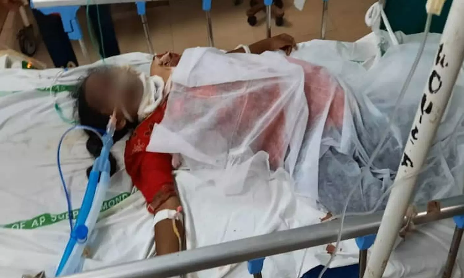 దారుణం.. బాలికపై మేనమామ లైంగిక దాడి.. గొంతుకోసి, యాసిడ్ పోసి..