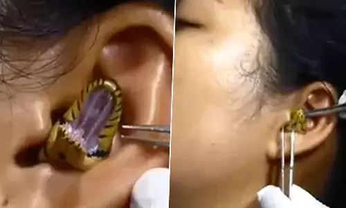 యువతి చెవిలోకి దూరిన పాము.. నెట్టింట వీడియో వైరల్