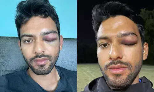 ఈ ఫోటోలో గాయంతో ఉన్న క్రికెటర్ ఎవరో తెలుసా..?