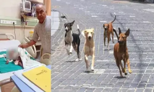 stray dogs killed 7 months boy, sector 100 in noida