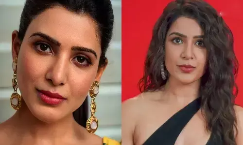 samantha face surgery, yashoda movie, shakuntalam
