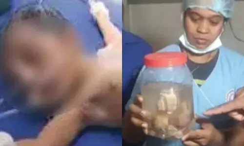 undeveloped fetuses, jharkhand