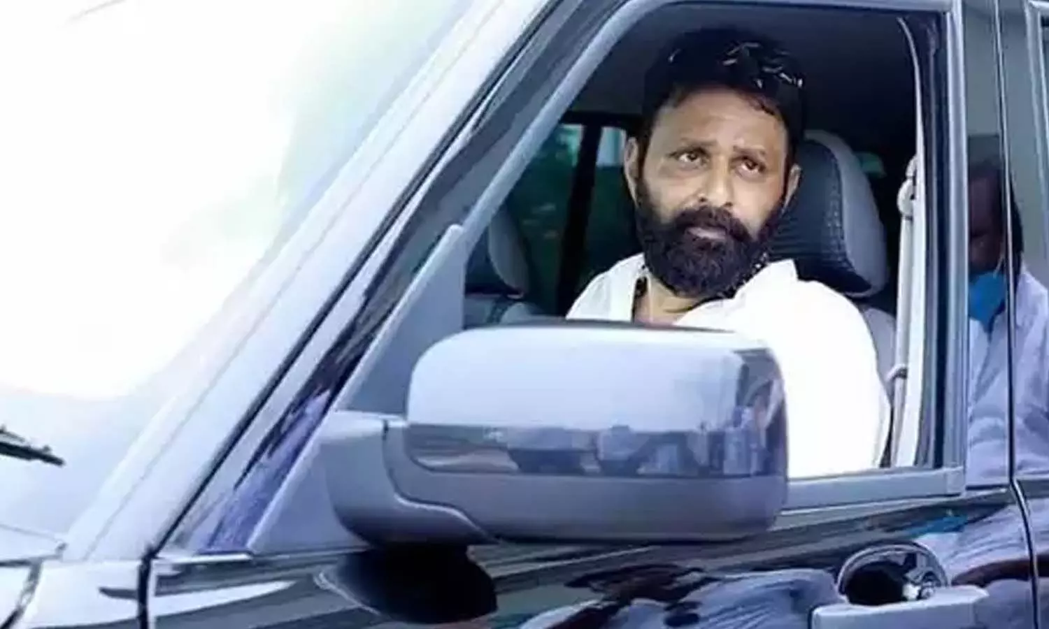 Kodali Nani : కొడాలి నాని హెల్త్ పై లేెటెస్ట్ అప్‌డేట్