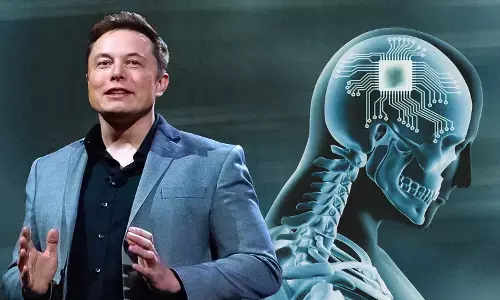 neura link, chip in human brain, what is neura link