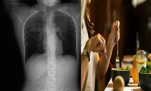 woman ends up with broken ribs, spicy food