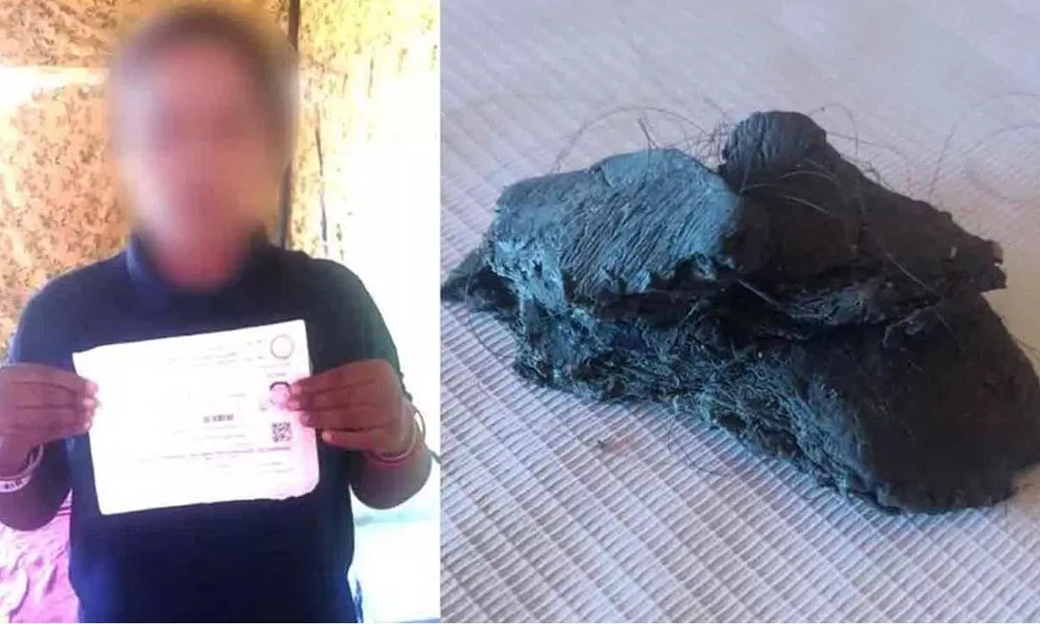 పోలీసు ఉద్యోగం కోసం.. ఎత్తు పెరగడానికి ఎత్తుగడ