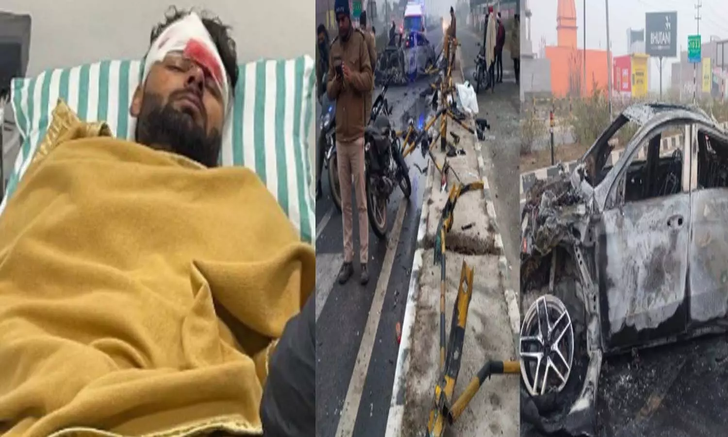 కాలు విరిగింది.. తలకు గాయమైంది