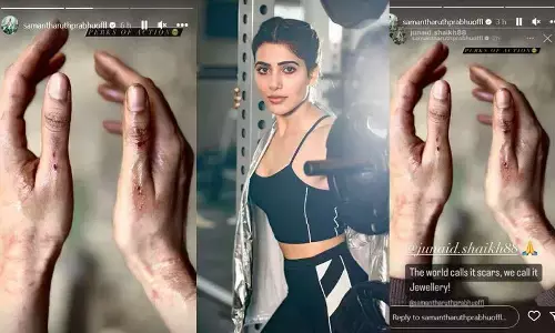 samantha ruth prabhu injured