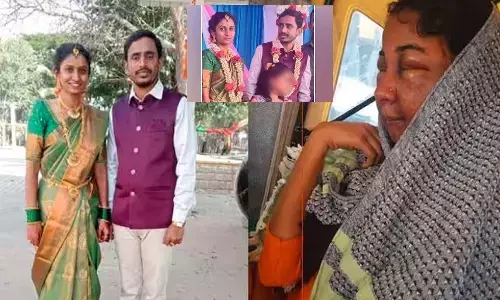 bride face disfigures after makeup, marriage cancelled in karnataka