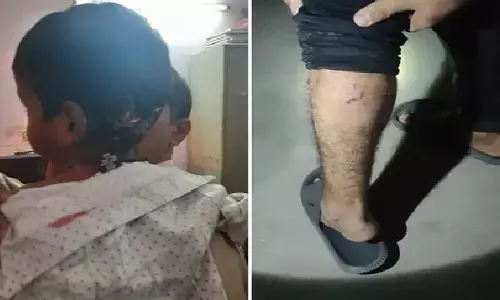 street dogs attack, hyderabad bala nagar