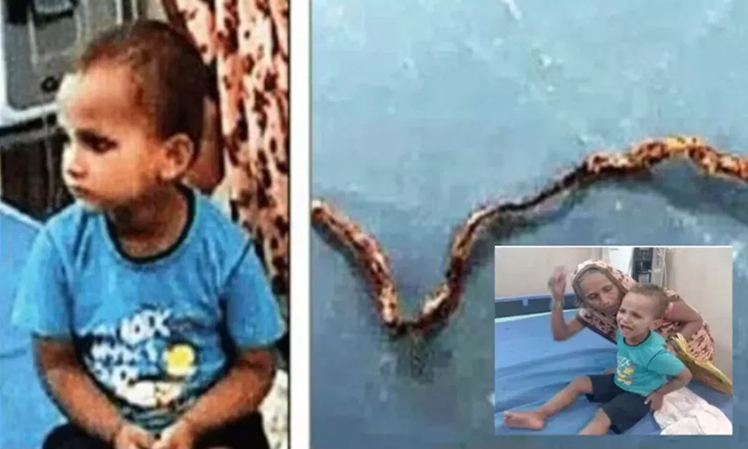 పాముని కొరికి చంపిన బాలుడు