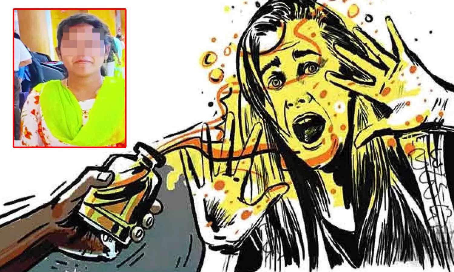 యాసిడ్ దాడి.. చూపుకోల్పోయిన మహిళ