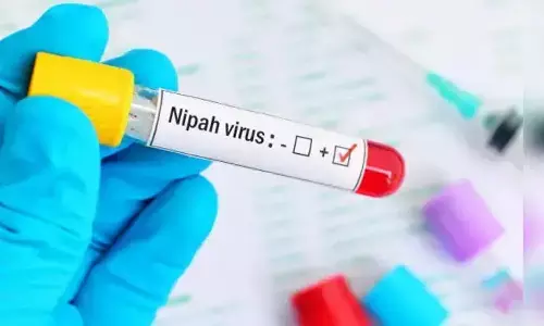 nipah virus, kerala, health department, alert