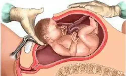 NRI, australia, india, c section