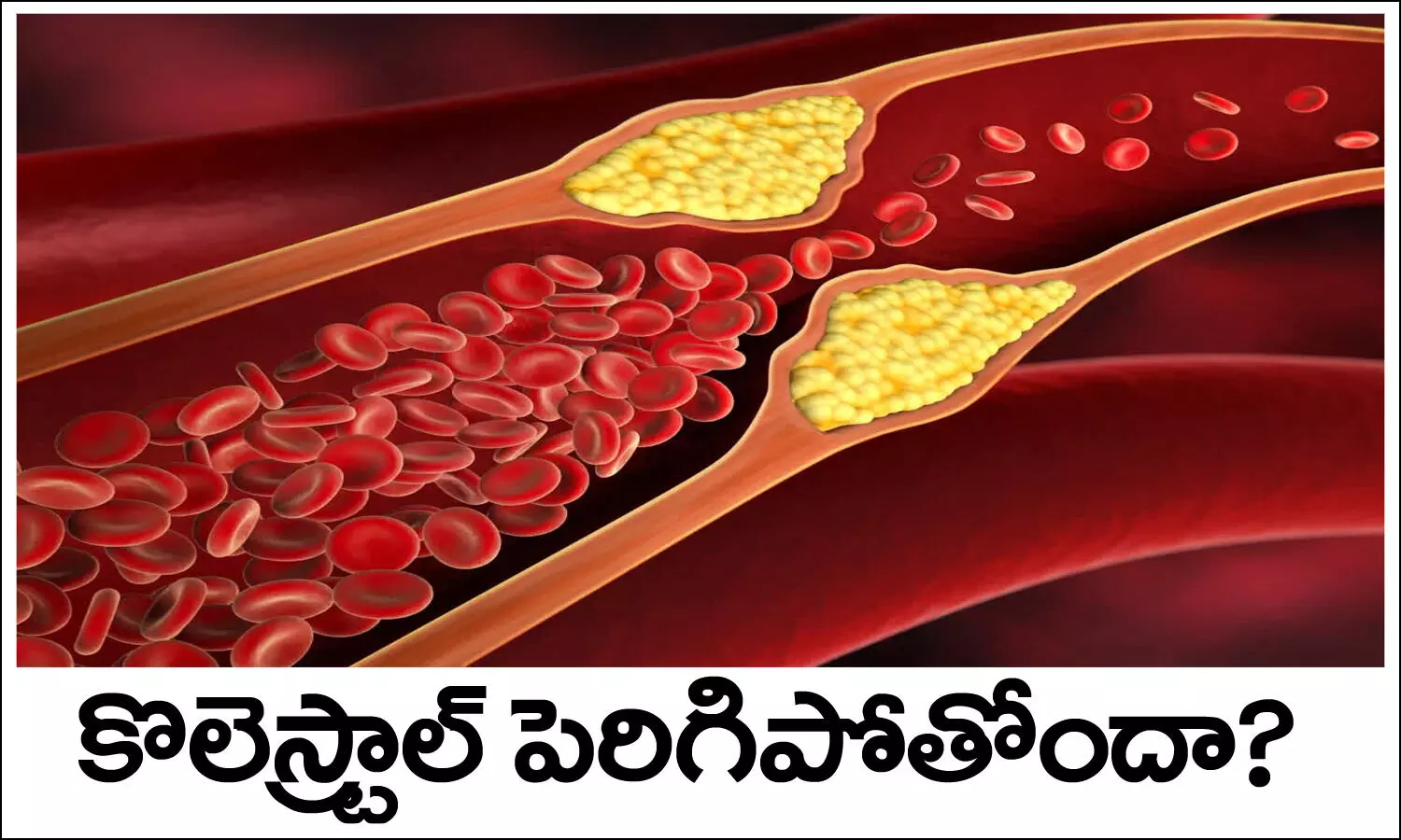మెడిసిన్‌ వాడినా కొలెస్ట్రాల్‌ తగ్గడం లేదా? ఇలా చేయండి