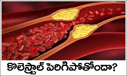 మెడిసిన్‌ వాడినా కొలెస్ట్రాల్‌ తగ్గడం లేదా? ఇలా చేయండి