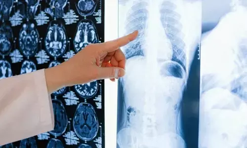 Hyderabad, Telangana, Pneumonia, Influenza