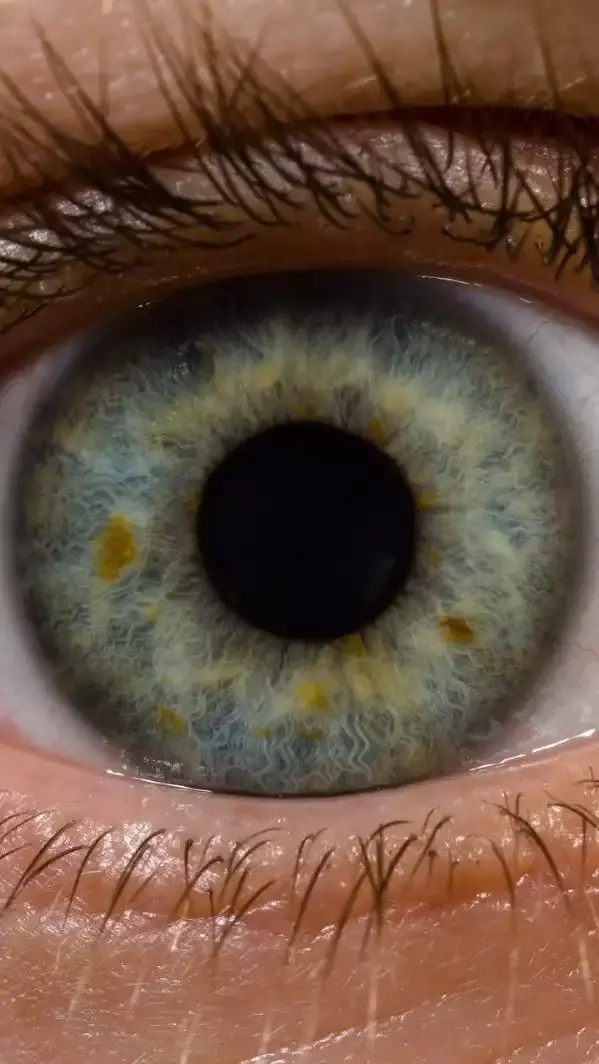 కంటి చూపు చాలా ముఖ్యం.. కాపాడుకోవాలంటే చేయాల్సిన పనులు ఇవే!!