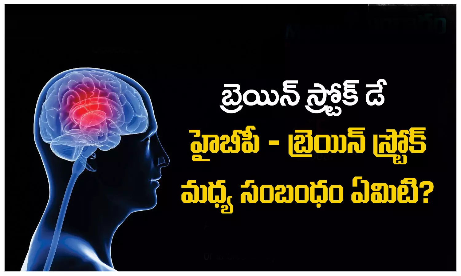 World Stroke Day: Brain Stroke, brain, stroke symptoms, Health Tips