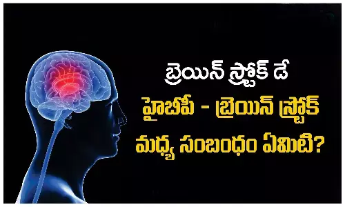 World Stroke Day: Brain Stroke, brain, stroke symptoms, Health Tips