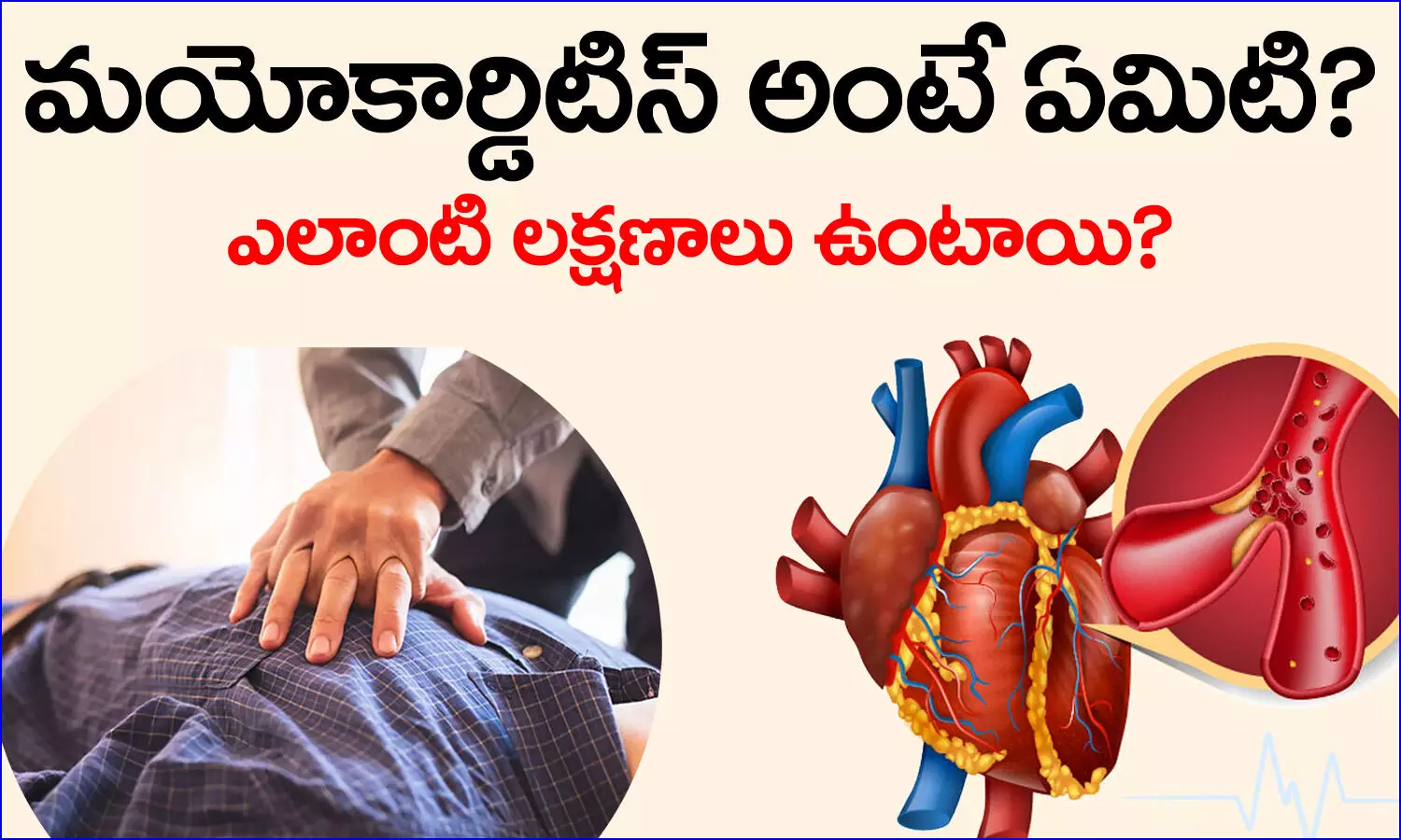 Myocarditis, Symptoms, Health Care, Health tips, telugu health tips
