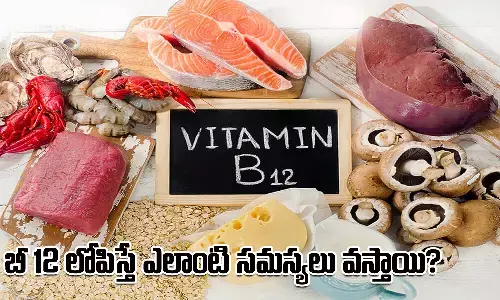 Vitamin-B12, B12 Deficiency, Health Problems, Health Tips, Health Care