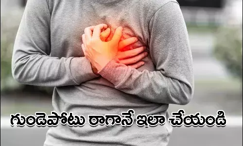 Heart Attack, CPR, CPR Immediately, Health Tips, Health Care
