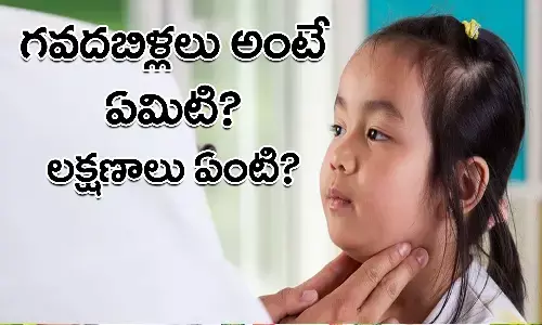 Mumps, Mumps Problems, Mumps Serious, Health Care, Health Tips