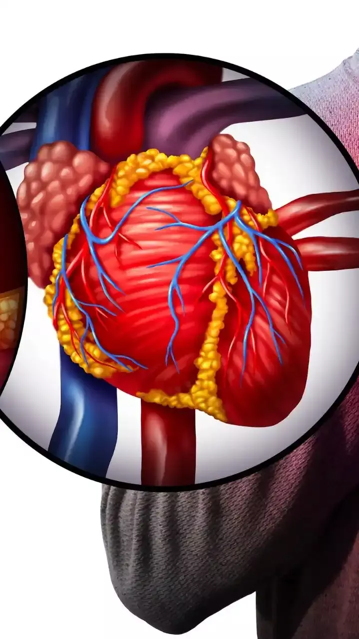 కొలెస్ట్రాల్ అధికంగా ఉంటే.. తీసుకోవాల్సిన చర్యలు