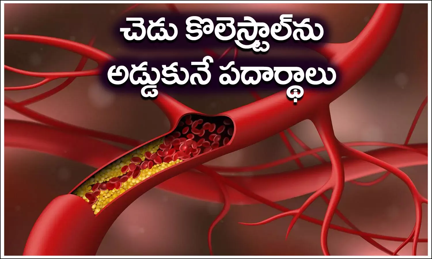 Cholesterol, Dangerous,Low-Density Lipoprotein, High-Density Lipoprotein, health news, health tips, health care