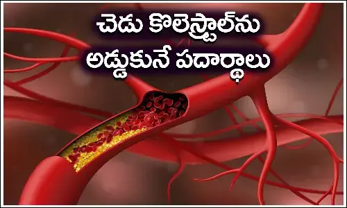 Cholesterol, Dangerous,Low-Density Lipoprotein, High-Density Lipoprotein, health news, health tips, health care