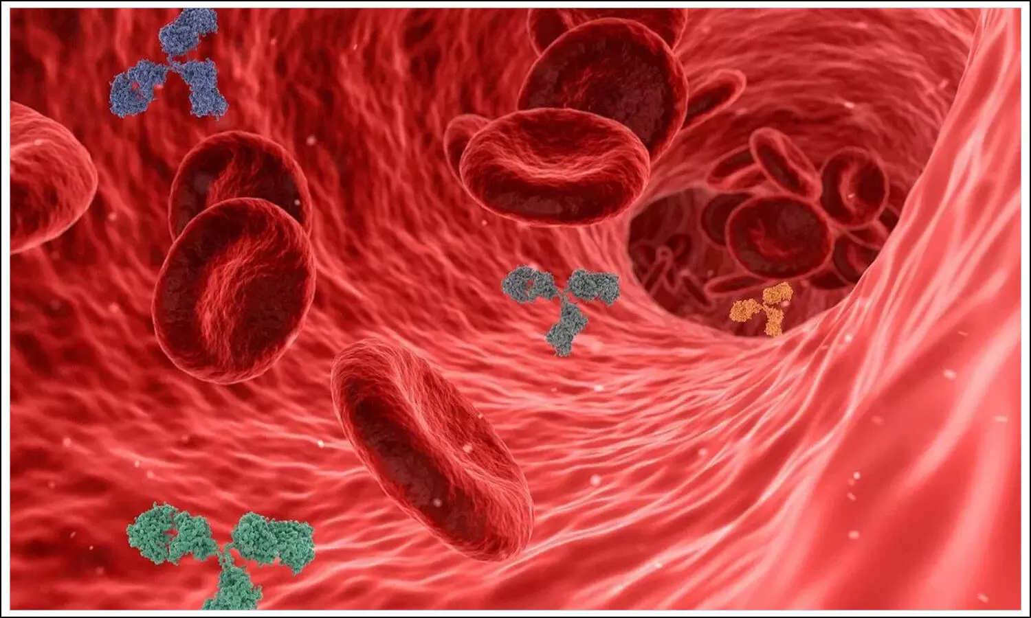 blood sugar high,Non-diabetic hyperglycemia, Diabetes, High Blood Sugar in non diabetics, Tips to Prevent diabetes, Symptoms for diabetes