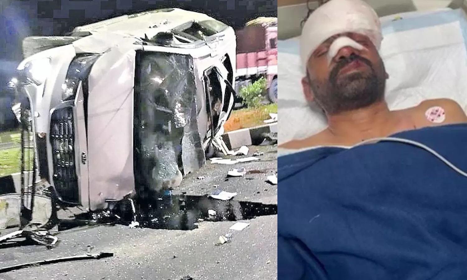 AP MLC : రోడ్డు ప్రమాదంలో ఎమ్మెల్సీకు తీవ్రగాయాలు