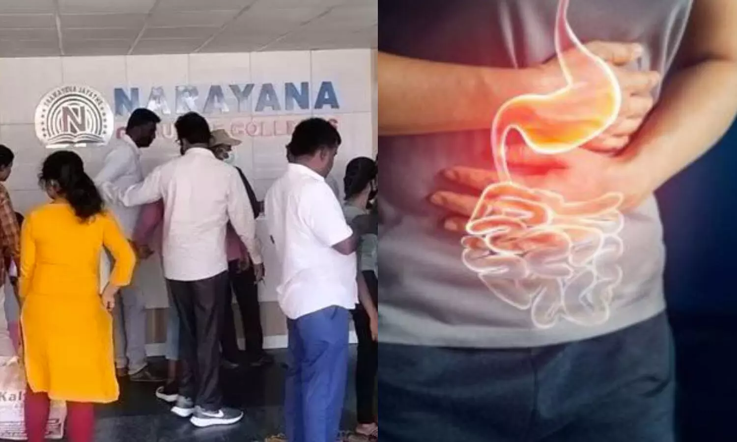 Hyderabad: నారాయణ కాలేజీ హాస్టల్‌లో ఫుడ్ పాయిజన్