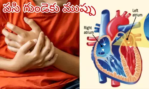 youth, heart stroke, junk food