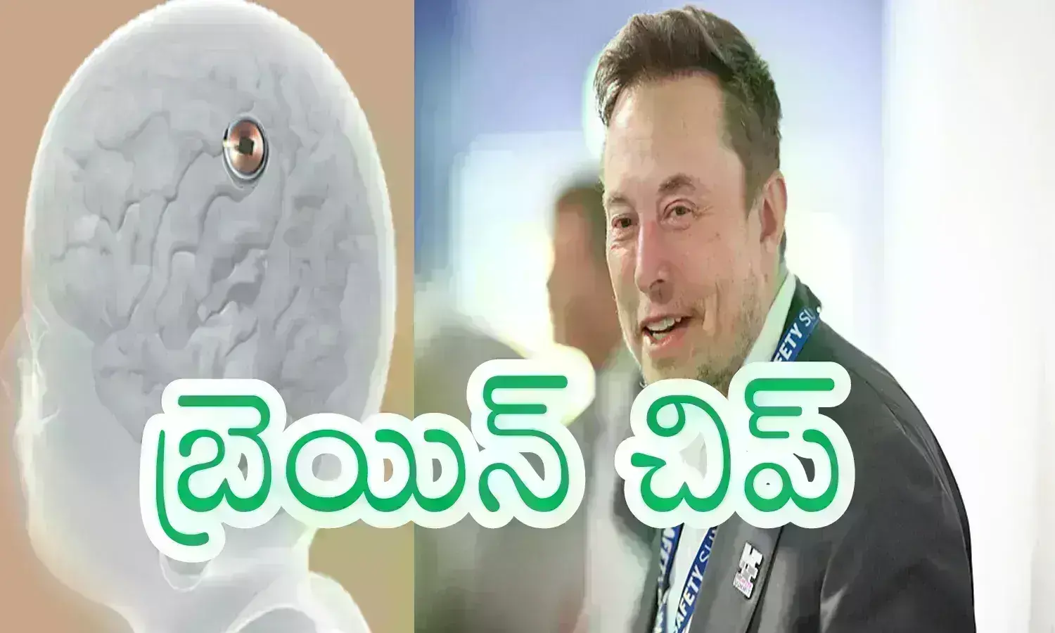 Elon Musk Neuralink : మెదడులో చిప్.. ఇక చింతలేని జీవితమంటున్న మస్క్