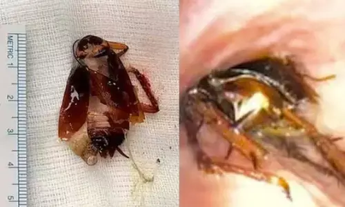 cockroach, lungs, breath, cockroach in lungs, kerala