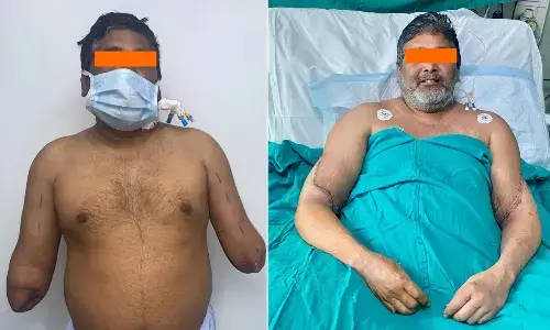 Painter, Hands, OrganDonation, Organs, Delhi