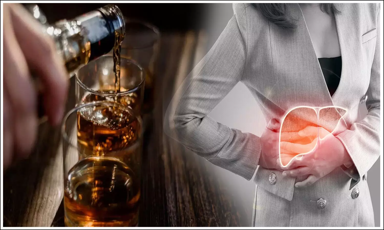 Liver Disease and Alcohol